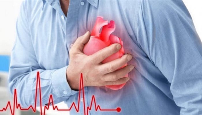 Nhồi máu cơ tim là gì? Cách sơ cứu cho người nhồi máu cơ tim